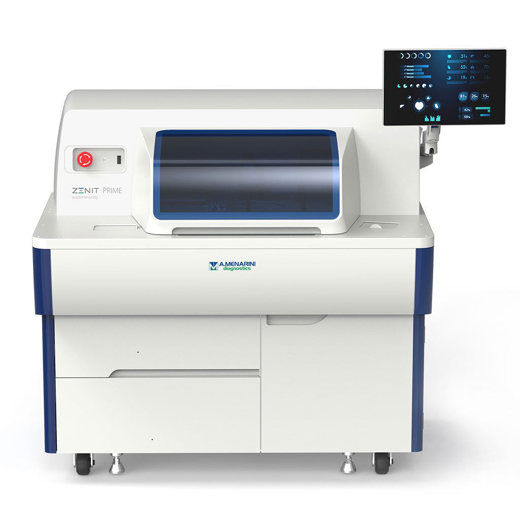Image: PRIME MDx all-in-one, sample-to-result, fully automated solution (Photo courtesy of Menarini)