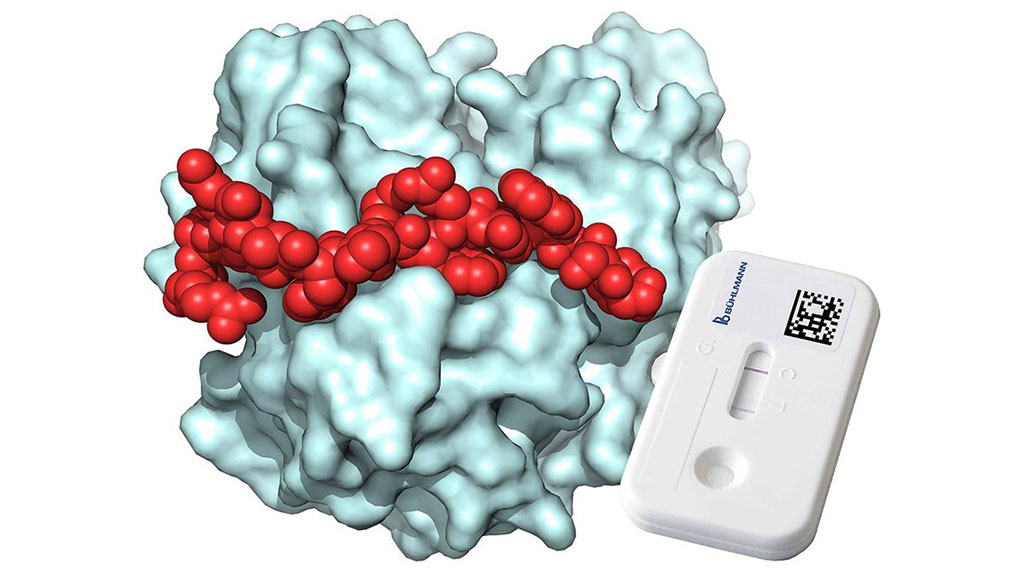 Image: Lateral flow assay detecting calprotectin in blood sample (Photo courtesy of BÜHLMANN & EPFL)