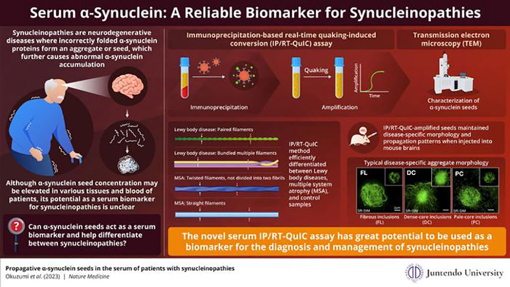 Image: The IP/RT-QuIC assay efficiently detects minute concentrations of serum α-synuclein seeds (Photo courtesy of Juntendo University)