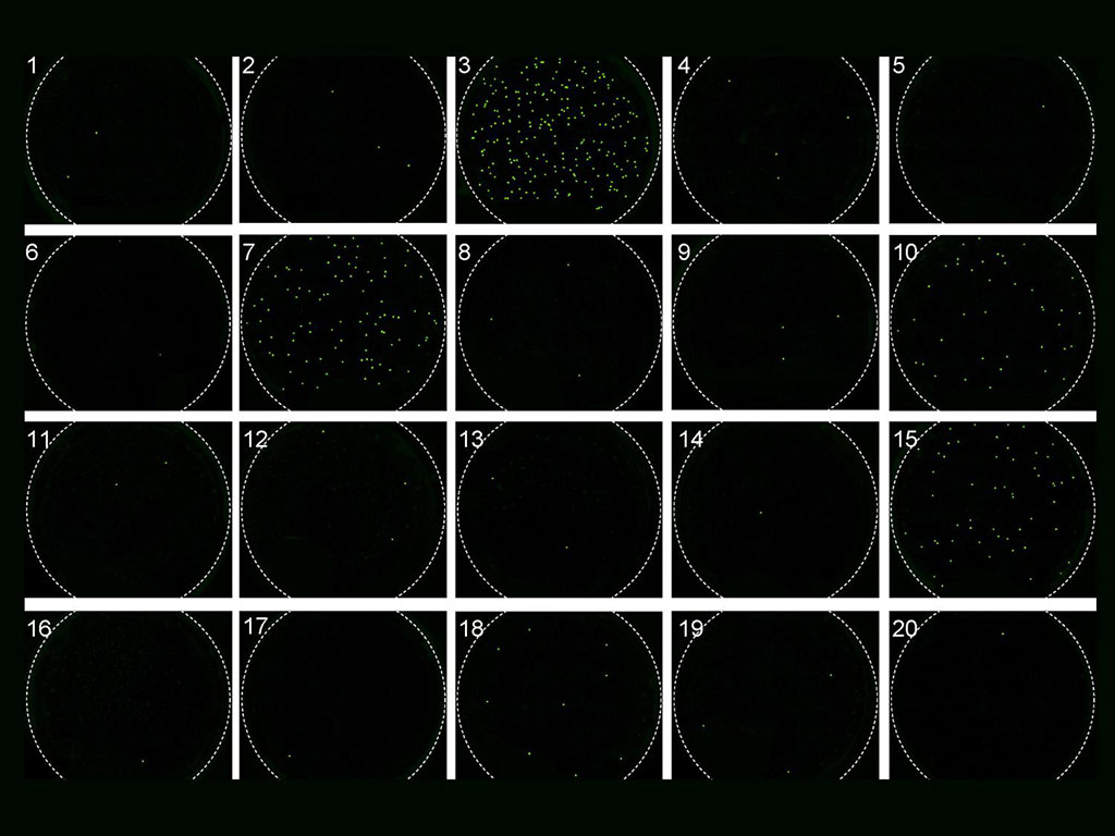 Image: In the new quantification method, a molecular signal shines green when HIV is detected in an RNA molecule (Photo courtesy of Penn State)