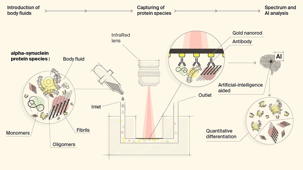 Image: A single sensor combines multiple advanced technologies to diagnose neurodegenerative diseases (Photo courtesy of EPFL)