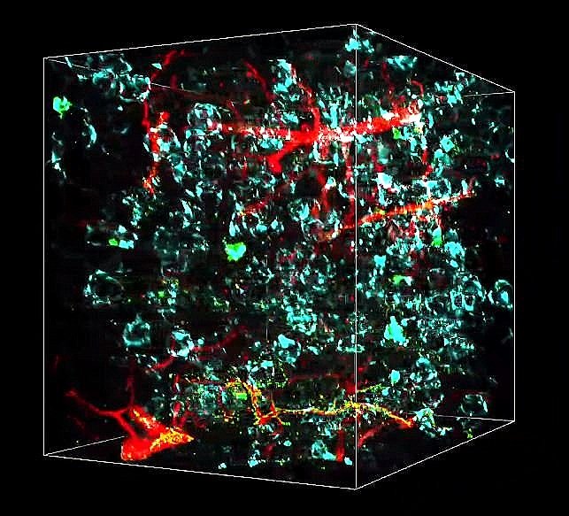 Image: The smart microscopy platform leverages multi-resolution open top light sheet microscope (Photo courtesy of Alpenglow)