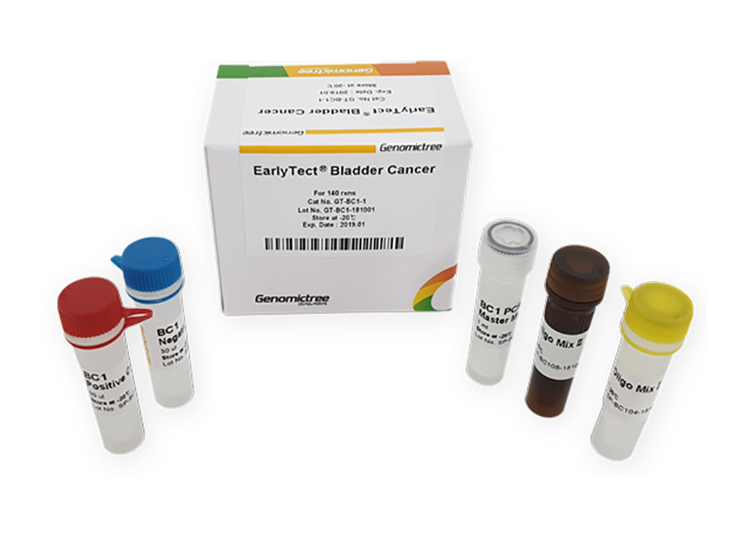 Image: The EarlyTect B test to detect bladder cancer is under development (Photo courtesy of Genomictree)