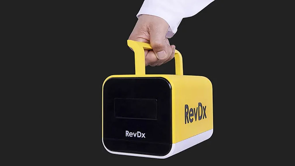 Image: The REVDX portable device aims to make basic blood tests results accessible to anyone, anywhere (Photo courtesy of EFA Technologies)