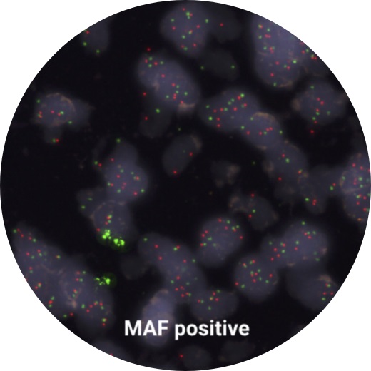 Image: The MAF Test supports informed decisions from pathologists for delivering personalized treatments (Photo courtesy of Inbiomotion)