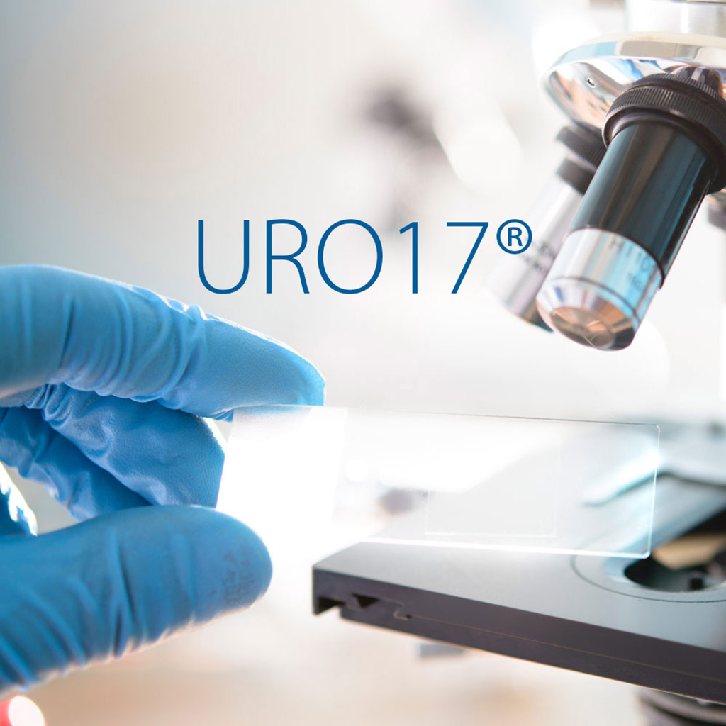 Image: Current data suggests URO17 is the most sensitive/specific for bladder cancer test (Photo courtesy of KDx Diagnostics)
