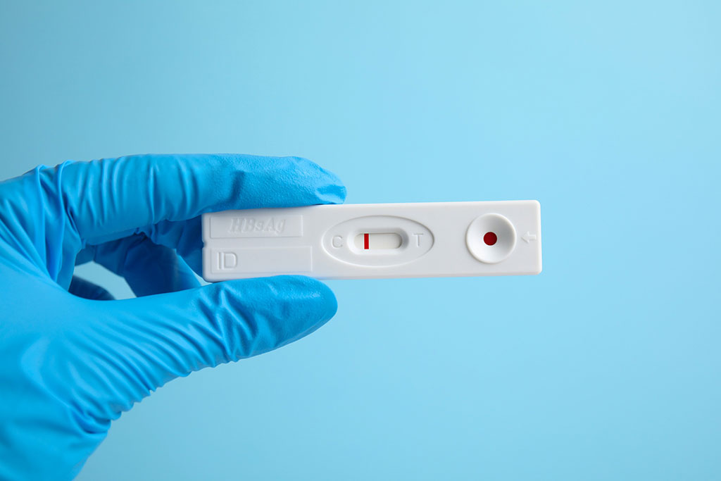 Image: The lateral flow biosensor detects nucleic acids present in chlamydia or gonorrhea from in two minutes (Photo courtesy of 123RF)