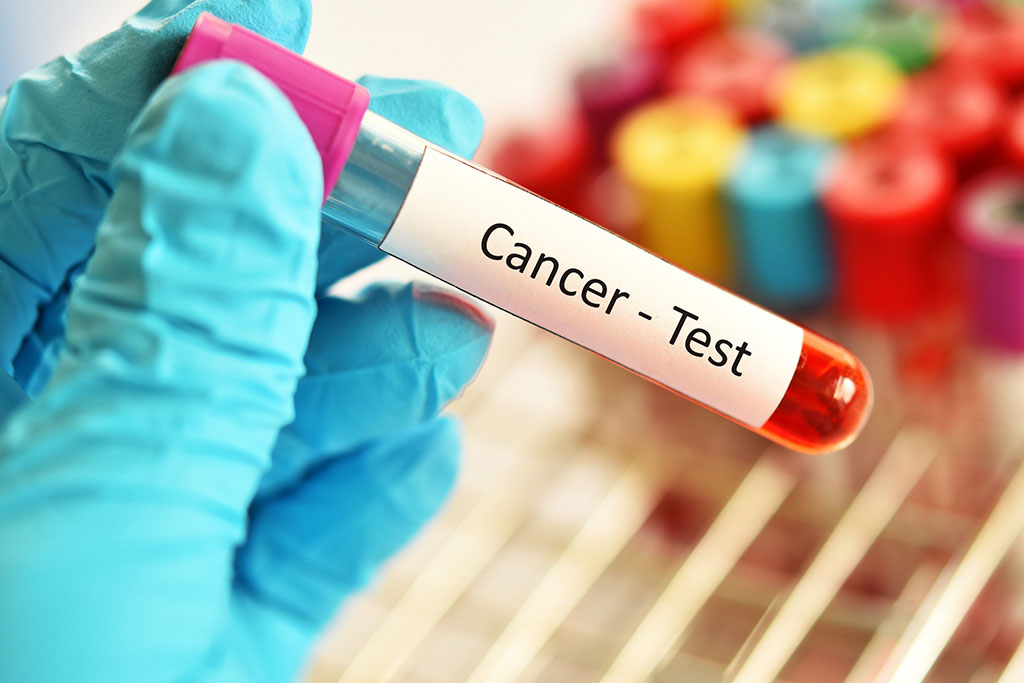 Diagnostic Technologies for Early Cancer Detection