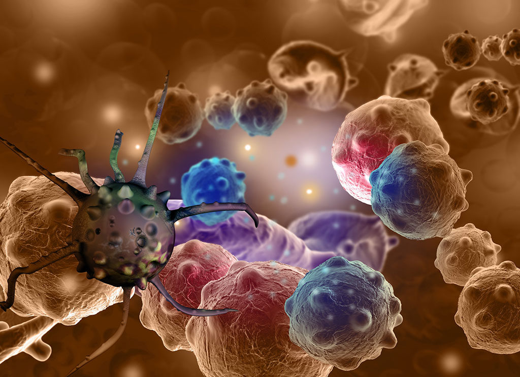 Image: Pathologic scoring has shown promise for assessing lung tumor therapy response (Photo courtesy of 123RF)