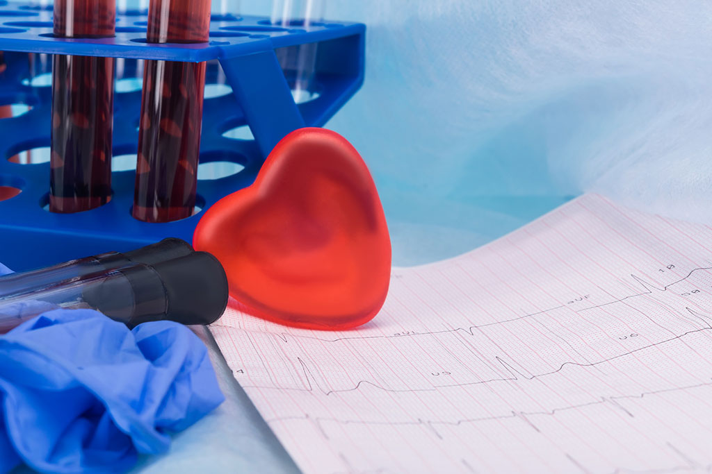 Image: A new blood test can improve diagnosis for patients with a heart muscle injury (Photo courtesy of 123RF)