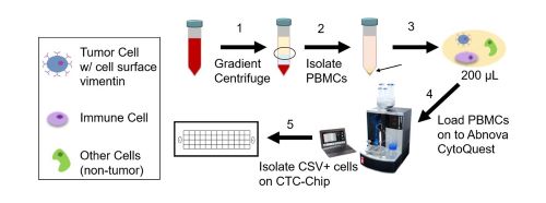 Image: The new tool could monitor treatment response and identify cancer relapse earlier (Photo courtesy of Long Dao, Ph.D.)