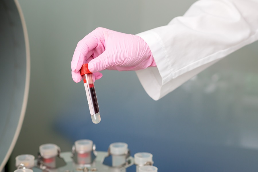 Image: Scientists have developed a simple blood test to quickly diagnose sarcoidosis (Photo courtesy of 123RF)