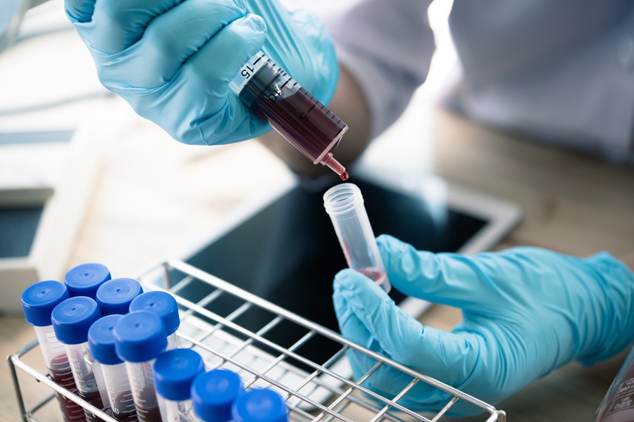Image: The blood test could make early Alzheimer’s diagnosis and treatment accessible to more people (Photo courtesy of 123RF)