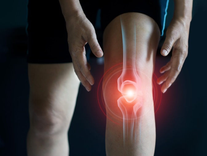 Image: The new blood test identifies key biomarkers of osteoarthritis (Photo courtesy of Shutterstock)