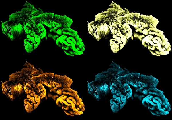 Image: 3D imaging of intact prostates using the 3D Spatial Biology platform (Photo courtesy of Alpenglow Biosciences)