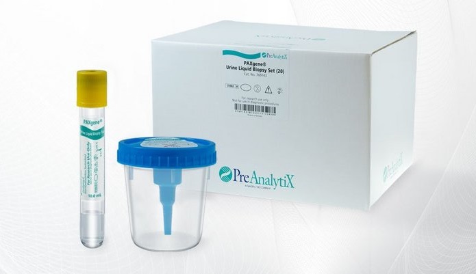 Image: The PAXgene Urine Liquid Biopsy Set is the first standardized preanalytical workflow that stabilizes cell-free DNA in urine for subsequent analysis (Photo courtesy of PreAnalytiX)