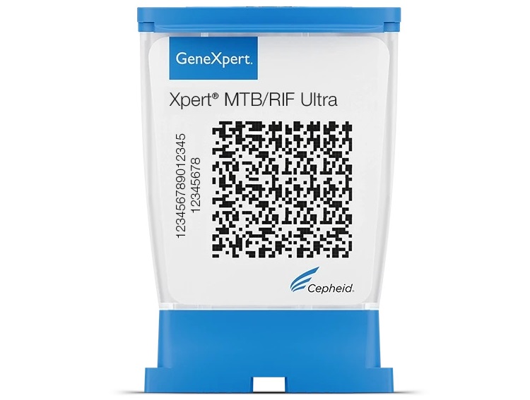 Image: Xpert MTB/RIF Ultra is the first test for TB diagnosis and antibiotic susceptibility testing to meet WHO\'s prequalification standards (Photo courtesy of Cepheid)