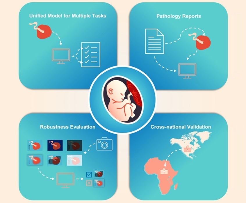 Image: The machine-learning model analyzes photos of placentas to detect health risks (Photo courtesy of Patterns, DOI: 10.1016/j.patter.2024.101097)