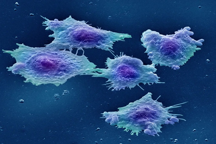 Image: Human bowel cancer cells (Photo courtesy of Annie Cavanagh/Wellcome Collection)