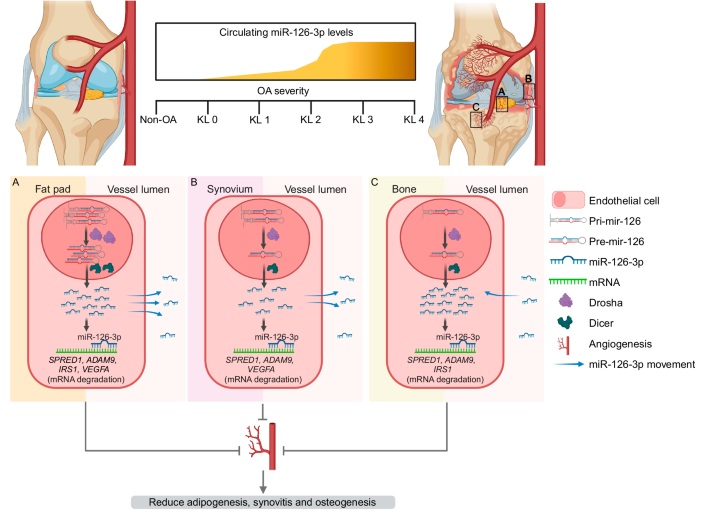 Image: Proposed mechanism of action of miR-126-3p in knee OA (Photo courtesy of Nature Communications/DOI: 10.1038/s41467-025-57308-5) Image: Proposed mechanism of action of miR-126-3p in knee OA (Photo courtesy of Nature Communications/DOI: 10.1038/s41467-025-57308-5)