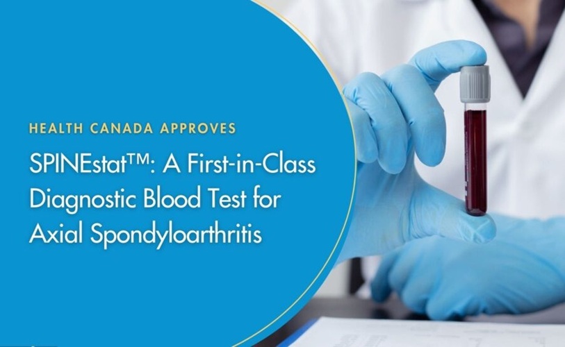 Image: Health Canada has approved SPINEstat, a first-in-class diagnostic blood test for axSpA, as a Class II medical device (Photo courtesy of Augurex) Image: Health Canada has approved SPINEstat, a first-in-class diagnostic blood test for axSpA, as a Class II medical device (Photo courtesy of Augurex)