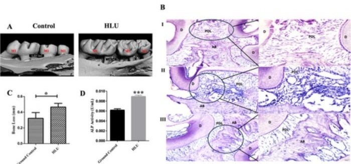 Image: Pancreatic cancer diagnosis (Photo courtesy of World Journal of Gastroenterology)