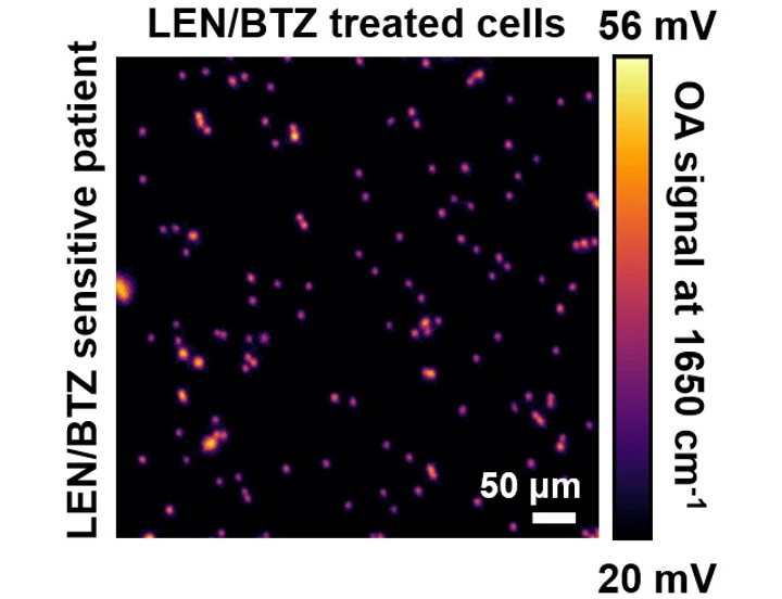 Image: Micrograph showing the distribution of misfolded proteins in myeloma cells (Photo courtesy of Helmholtz Munich) Image: Micrograph showing the distribution of misfolded proteins in myeloma cells (Photo courtesy of Helmholtz Munich)