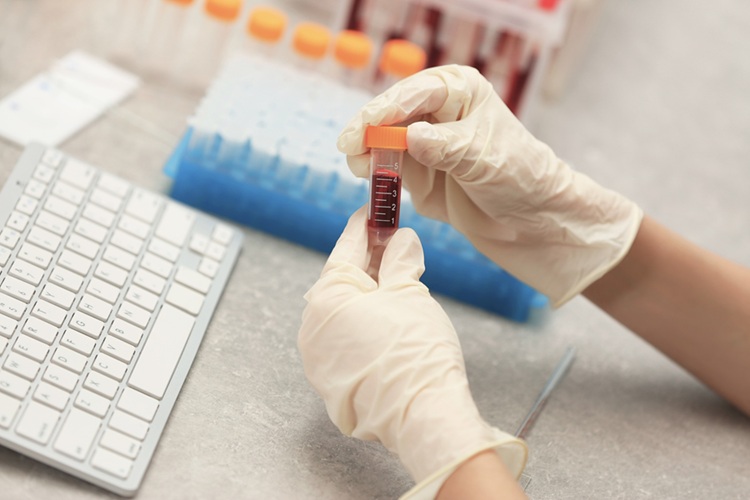 Image: Researchers have developed the first ever test for early detection of multiple sclerosis (Photo courtesy of 123RF) Image: Researchers have developed the first ever test for early detection of multiple sclerosis (Photo courtesy of 123RF)
