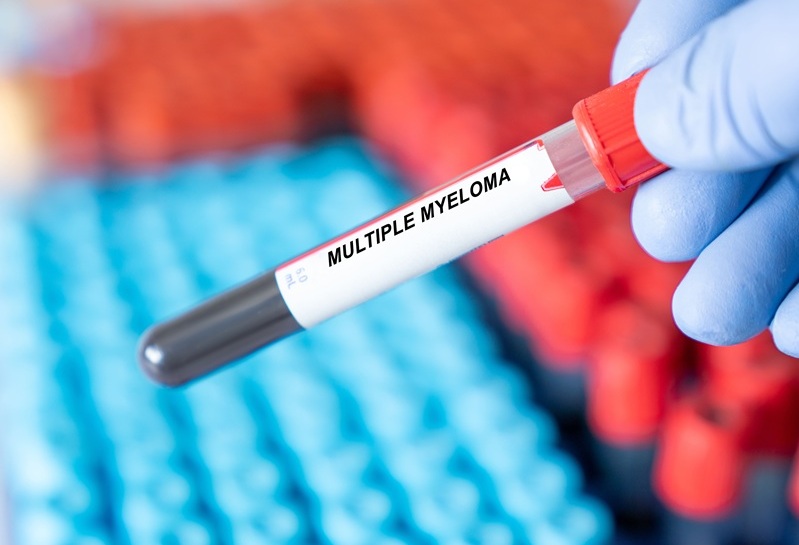 Image: The blood-based technology could replace or complement invasive biopsies (Photo courtesy of Adobe Stock) Image: The blood-based technology could replace or complement invasive biopsies (Photo courtesy of Adobe Stock)