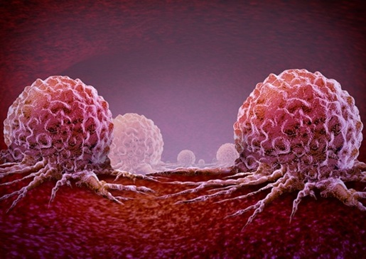 Image: Known risk factors, including genetics and lifestyle, do not fully explain the upward trend of breast cancer rates (Photo courtesy of Shutterstock)) Image: Known risk factors, including genetics and lifestyle, do not fully explain the upward trend of breast cancer rates (Photo courtesy of Shutterstock))