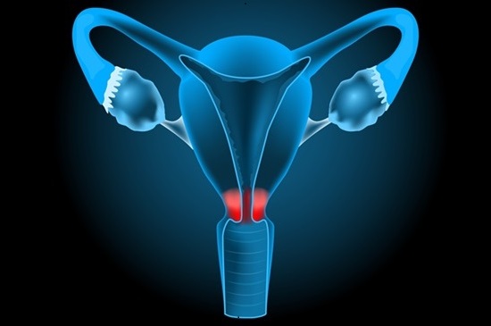 Image: AI can increase access to life-saving cervical cancer diagnostics for women (Photo courtesy of Shutterstock) Image: AI can increase access to life-saving cervical cancer diagnostics for women (Photo courtesy of Shutterstock)