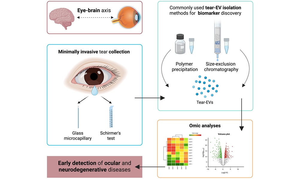 Image: Tears could open a new avenue for diagnosing and monitoring eye and neurodegenerative diseases (Sanroque-Muñoz et al., Extracell Vesicles Circ Nucleic Acids, 2025; DOI: 10.20517/evcna.2025.72)
