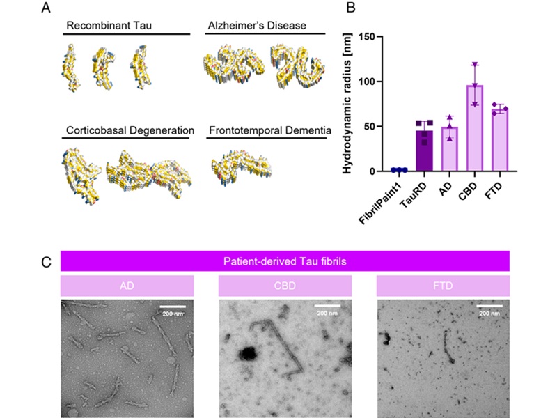 Image: Size assessment of patient-derived material from various tauopathies (Aragonès Pedrola J. et al., PNAS (2025); DOI: 10.1073/pnas.2502847122)