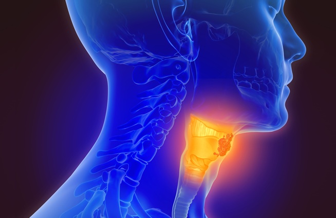 Image: The technology can diagnose head and neck cancer early with a drop of saliva (Photo courtesy of Adobe Stock)