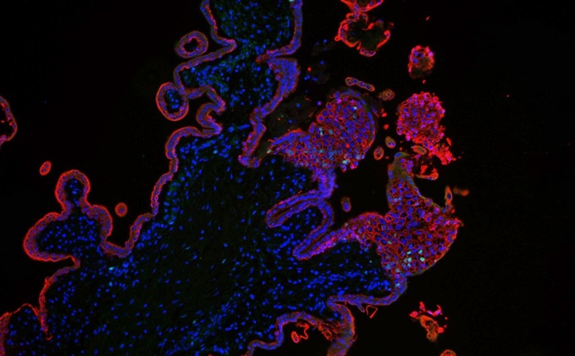 Image: The stained cells are trophoblasts of the placenta tissue (photo courtesy of Rabia Anwar)