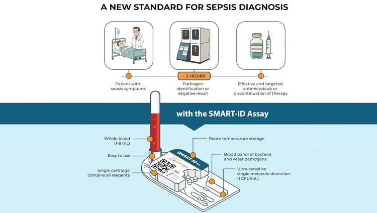 Image: The SMART-ID Assay delivers broad pathogen detection without the need for culture (Photo courtesy of Scanogen)