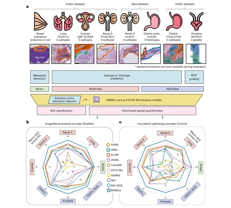Image: SMMILe enables accurate spatial quantification in digital pathology using multiple-instance learning (Gao, Z et al. Nature Cancer, 2025; DOI: 10.1038/s43018-025-01060-8)