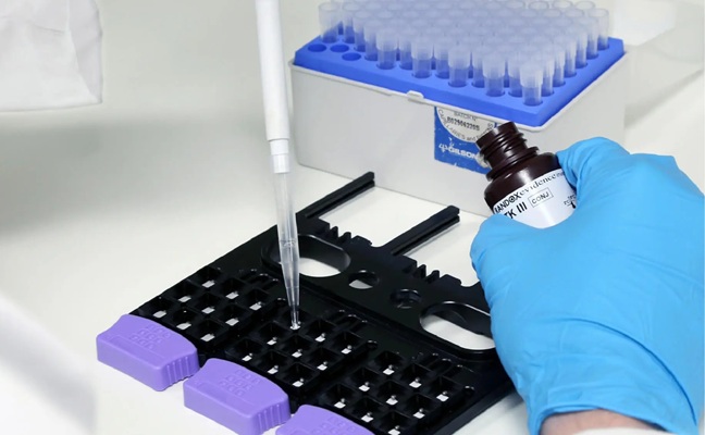 Image: The T1D GRS Array uses patented Biochip array technology (Photo courtesy of Randox)