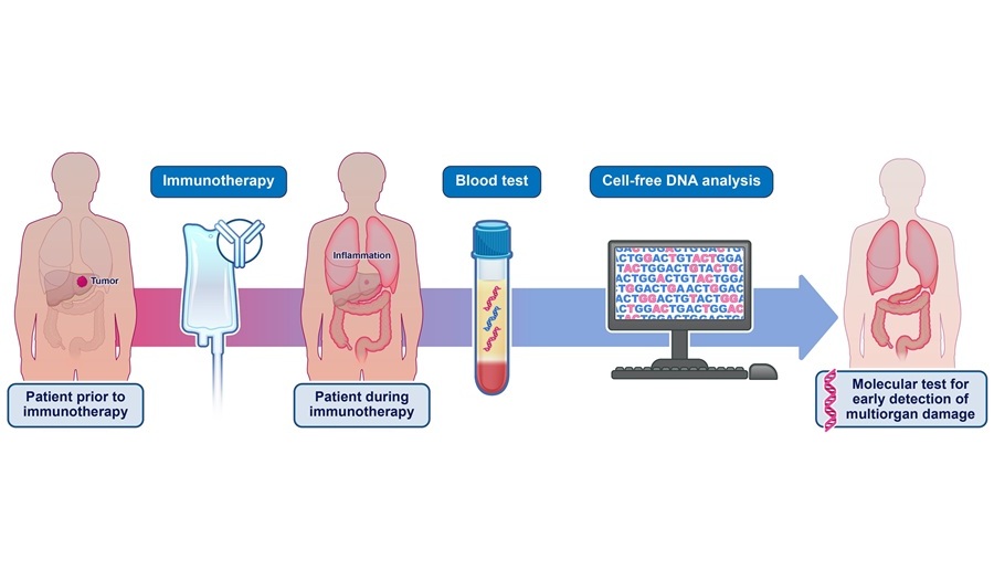 Image: The noninvasive cfDNA blood test can identify adverse events from immune checkpoint therapy in cancer patients (Photo courtesy of Elizabeth Cook)