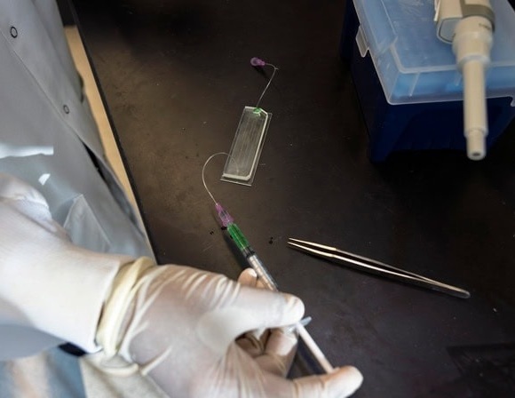 Image: The GlioExoChip chip provides a quick and minimally invasive way to monitor glioblastoma treatment response (Photo courtesy of University of Michigan)