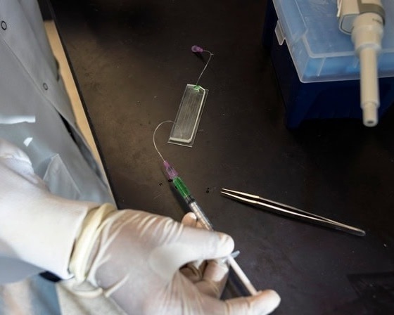 Image: The GlioExoChip chip provides a quick and minimally invasive way to monitor glioblastoma treatment response (Photo courtesy of University of Michigan)