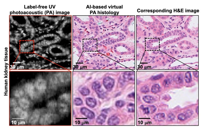 Image: Comparative analysis of SRUV PA virtual histology images of human kidney tissues (Byullee Park et al., Science Advances, 2025; DOI:10.1126/sciadv.adz1820)