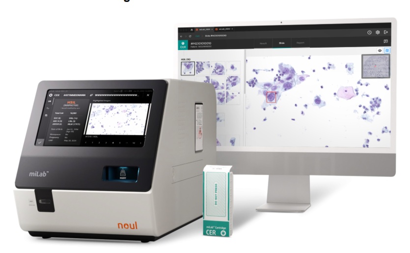 Noul’s AI-based cervical cancer diagnostic solution, miLab CER (Photo courtesy of Noul)