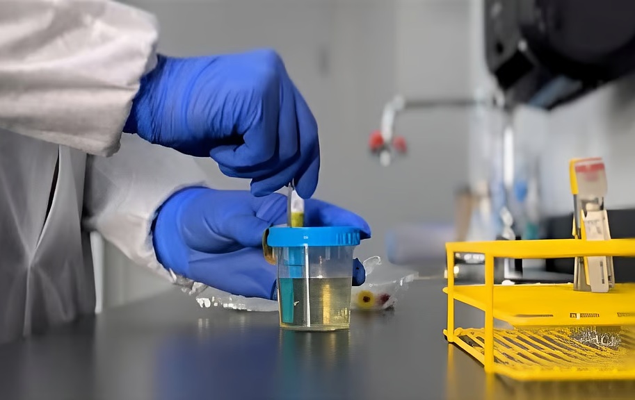 Image: The BD Vacutainer Urine Complete Cup Kit preserves specimen quality, streamlines testing, and helps reduce repeat collections (Photo courtesy of BD)