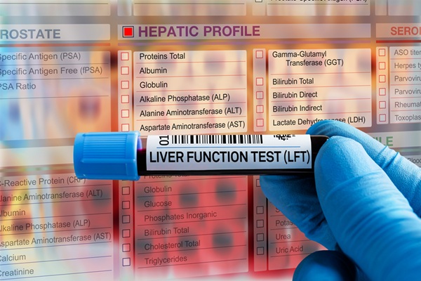 Image: A simple blood-based score can distinguish alcohol-related liver injury from metabolic fatty liver disease (Photo courtesy of 123RF)