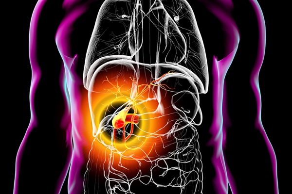 Image: Distinct blood-based metabolic patterns can differentiate gallbladder cancer cases with and without gallstones (Photo courtesy of 123RF)