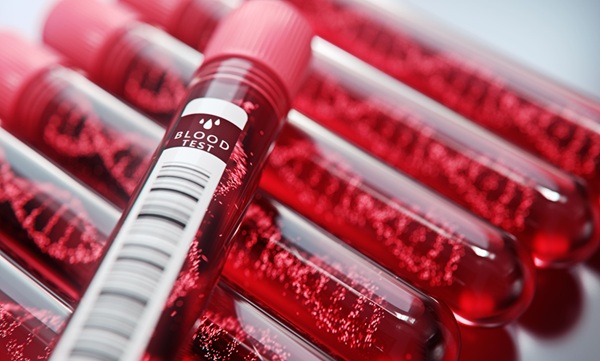 Image: Fragments of tumor DNA in the blood can predict whether chemotherapy will be effective (Photo courtesy of Adobe Stock)