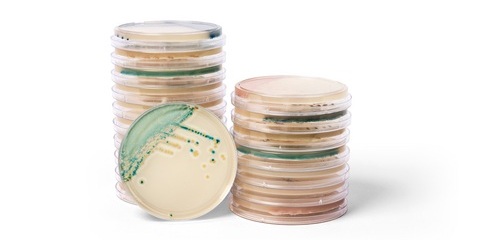 Image: Thermo Scientific Brilliance Candida 2 Agar and Spectra Candida Agar, color-based (chromogenic) culture media are designed to help laboratories quickly detect and differentiate clinically important Candida species (Photo courtesy of Thermo Fisher Scientific)