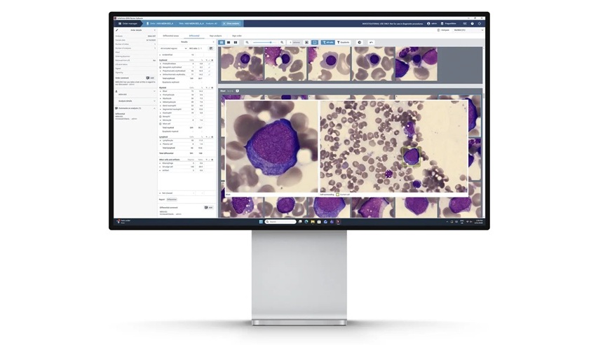 Image: Laboratories in the EMEA region can now implement a digital, AI-assisted workflow for bone marrow morphology (photo courtesy of Cellavision)