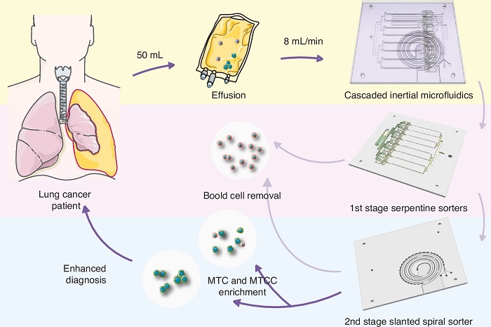 Image: Schematic illustration of high-throughput, continuous-flow, and multi-scale enrichment of viable MTCs and MTCCs from pleural effusion samples using cascaded inertial microfluidics (Zhu, Z., Ren, H., Zhang, Z. et al. Microsyst Nanoeng 12, 101 (2026). doi.org/10.1038/s41378-026-01235-y)
